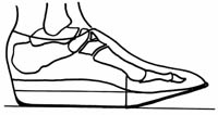 metatarsal-head-rocker-forefoot-rocker-sole.jpg